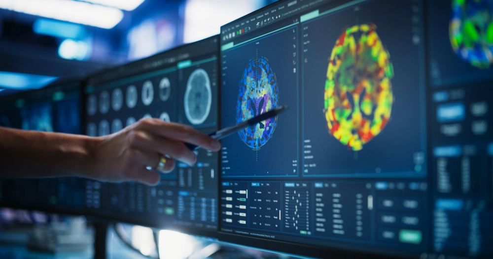 Doctor pointing at brain scan images on monitors | Arrange an X-Ray with a Doctor in Turkey | Online Doctor | E-rx.online